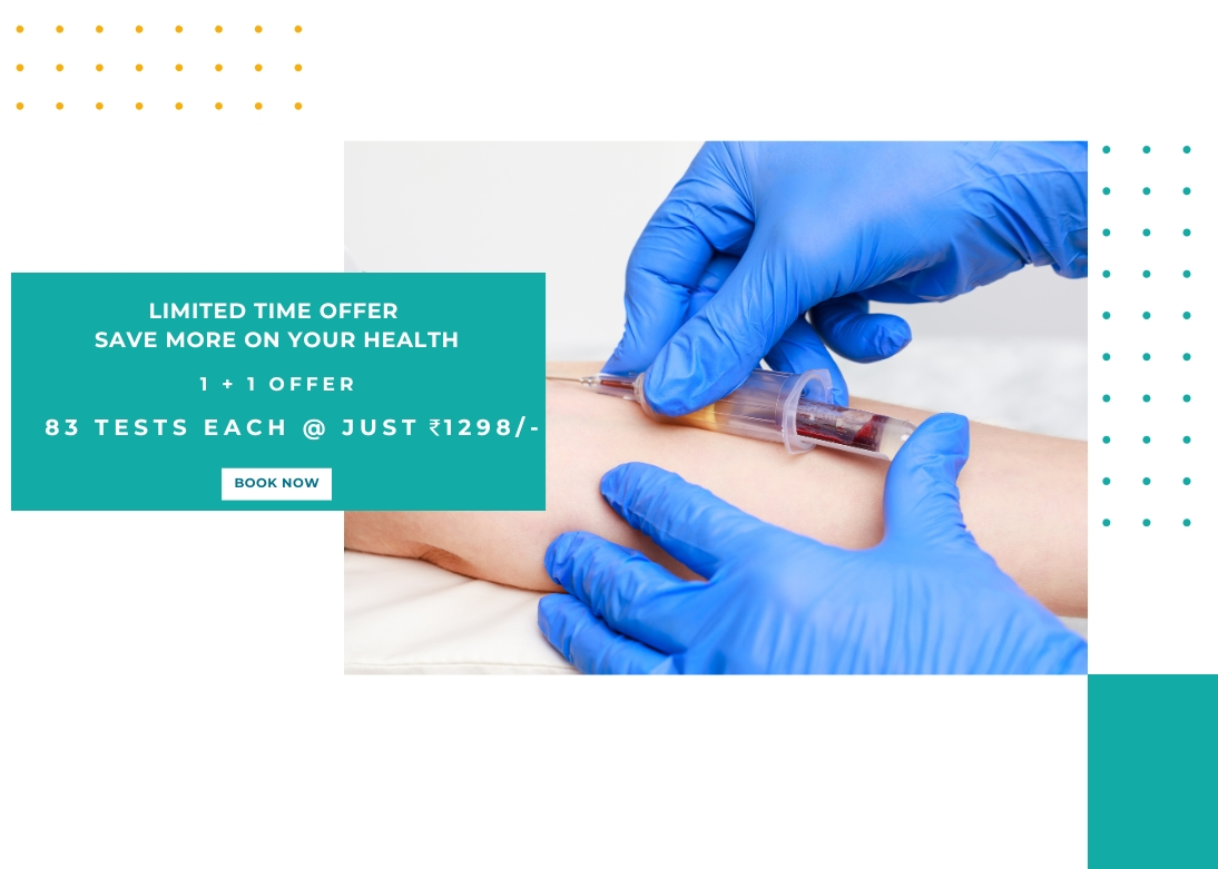 One Plus One Offer